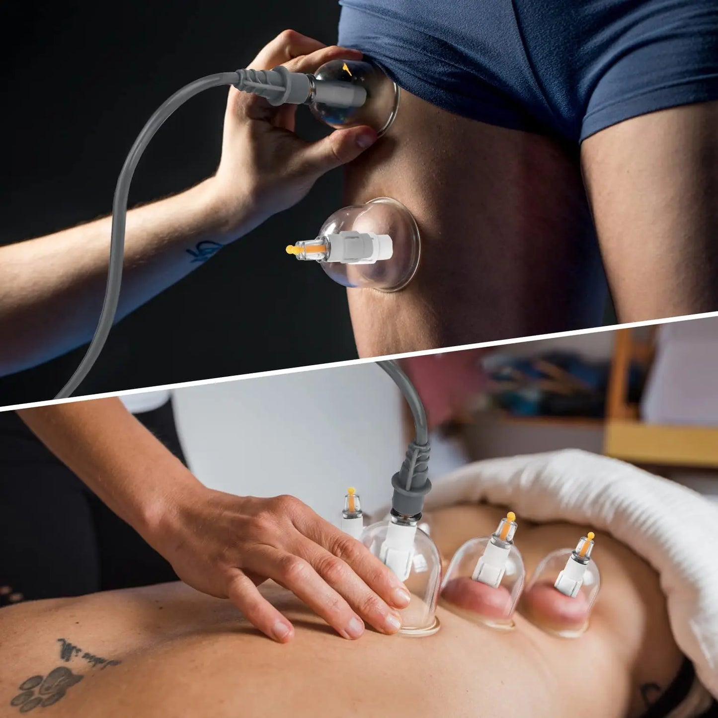Ensemble de ventouses sous vide 24 pièces (Hijama)– kit de massage thérapeutique et anti‑cellulite