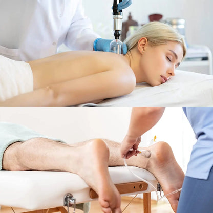 Ensemble de ventouses sous vide 24 pièces (Hijama)– kit de massage thérapeutique et anti‑cellulite